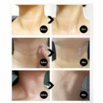 Collagen Naite Thread Neck Cream Premium 2.0 100ml - Medi-Peel - Image 2