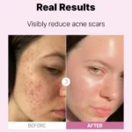The Niacinamide 15 Serum Cosrx - Κορεάτικα Καλλυντικά