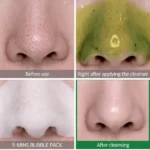 Bye Bye Blackhead 30 Days Miracle Bubble Cleanser - Some by Mi - Image 2