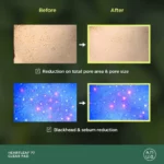 Heartleaf 77% Clear Pad Anua - Κορεάτικα Καλλυντικά
